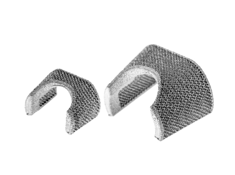 3D Metal Femoral Cones